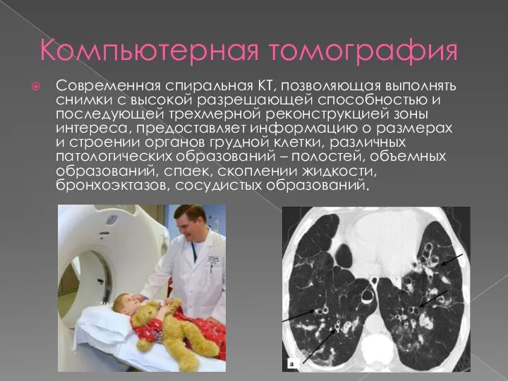 Компьютерная томография Современная спиральная КТ, позволяющая выполнять снимки с высокой