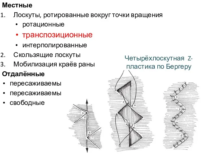 Местные Лоскуты, ротированные вокруг точки вращения ротационные транспозиционные интерполированные Скользящие