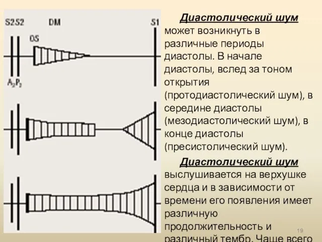 Диастолический шум может возникнуть в различные периоды диастолы. В начале