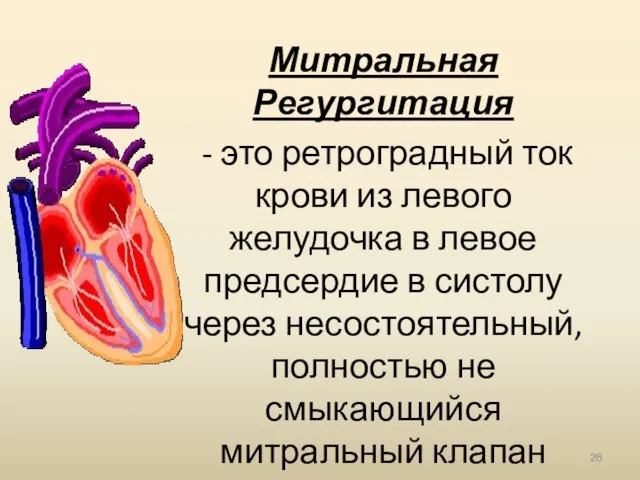 Митральная Регургитация - это ретроградный ток крови из левого желудочка