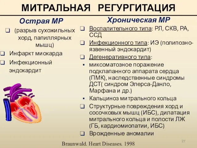 МИТРАЛЬНАЯ РЕГУРГИТАЦИЯ Острая МР (разрыв сухожильных хорд, папиллярных мышц) Инфаркт
