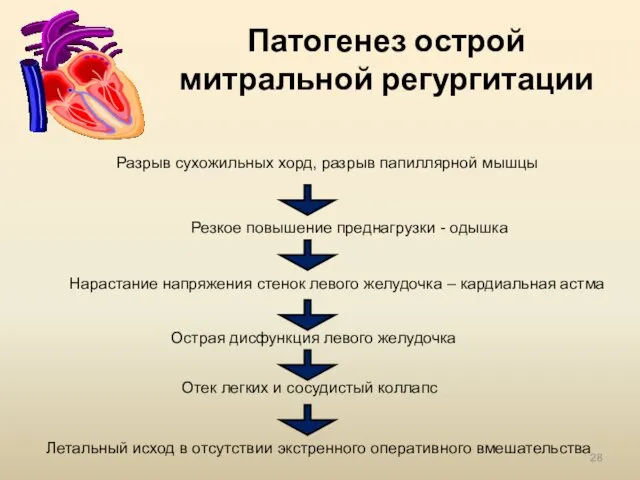 Патогенез острой митральной регургитации Разрыв сухожильных хорд, разрыв папиллярной мышцы