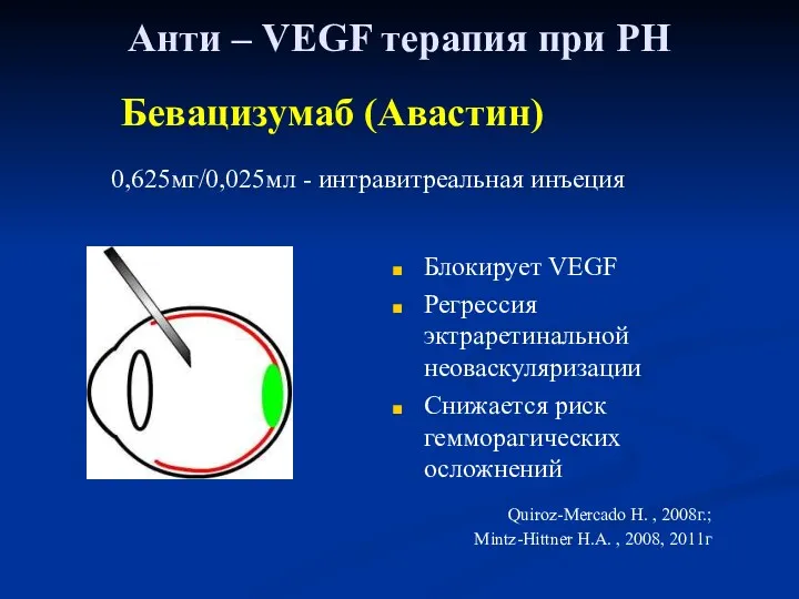 Бевацизумаб (Авастин) 0,625мг/0,025мл - интравитреальная инъеция Анти – VEGF терапия