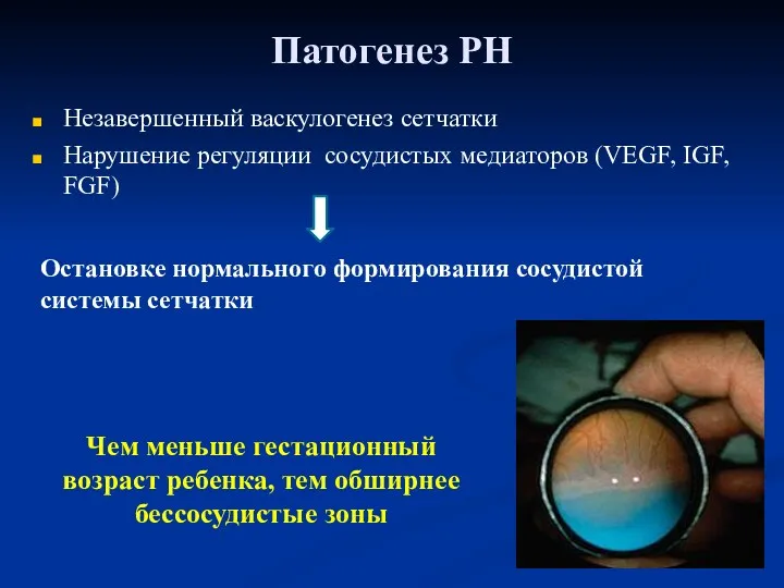 Незавершенный васкулогенез сетчатки Нарушение регуляции сосудистых медиаторов (VEGF, IGF, FGF)