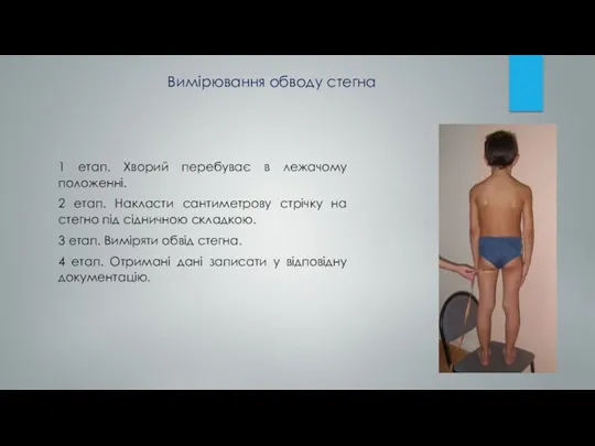 1 етап. Хворий перебуває в лежачому положенні. 2 етап. Накласти