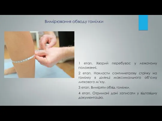 1 етап. Хворий перебуває у лежачому положенні. 2 етап. Накласти