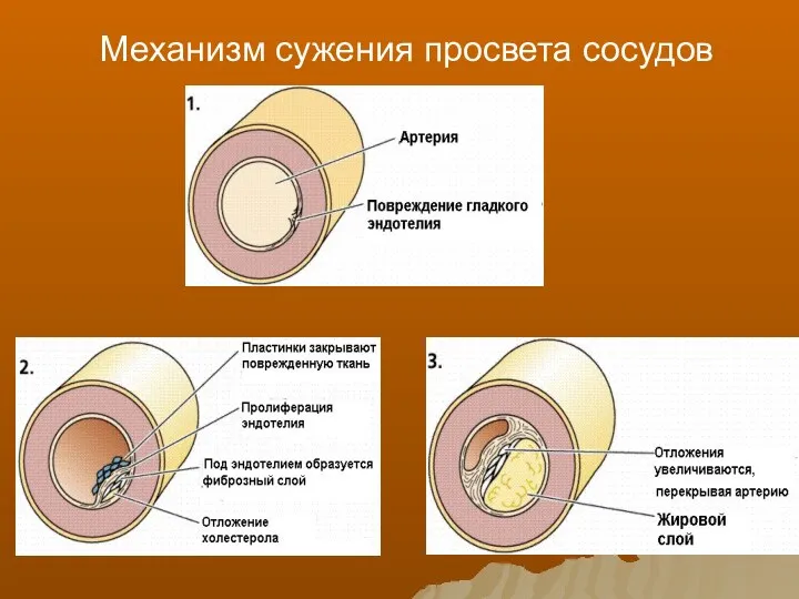 Механизм сужения просвета сосудов