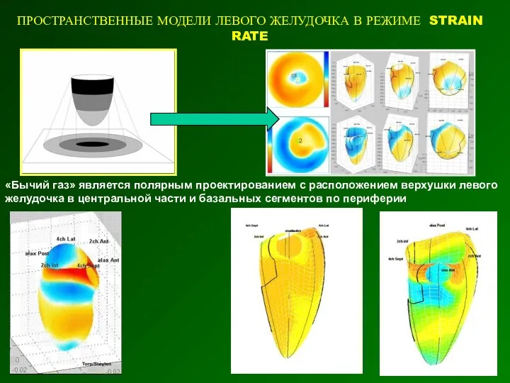 ПРОСТРАНСТВЕННЫЕ МОДЕЛИ ЛЕВОГО ЖЕЛУДОЧКА В РЕЖИМЕ STRAIN RATE «Бычий газ»