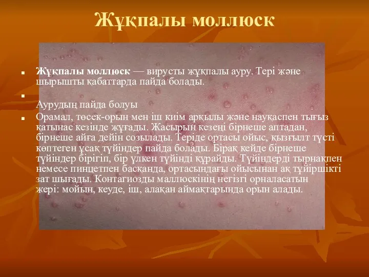 Жұқпалы моллюск Жұқпалы моллюск — вирусты жұқпалы ауру. Тері және