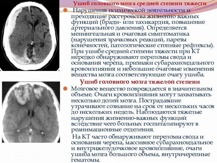 Ушиб головного мозга средней степени тяжести Нарушения психической деятельности и