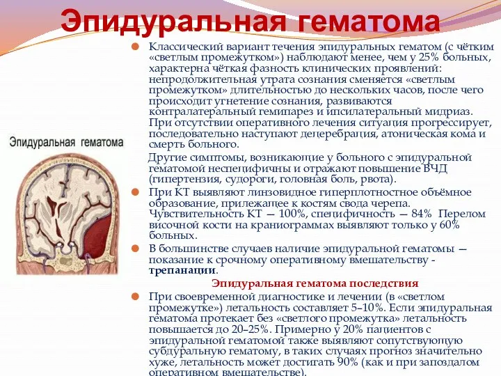 Эпидуральная гематома Классический вариант течения эпидуральных гематом (с чётким «светлым