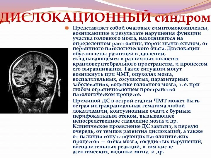 ДИСЛОКАЦИОННЫЙ синдром Представляет собой очаговые симптомокомплексы, возникающие в результате нарушения