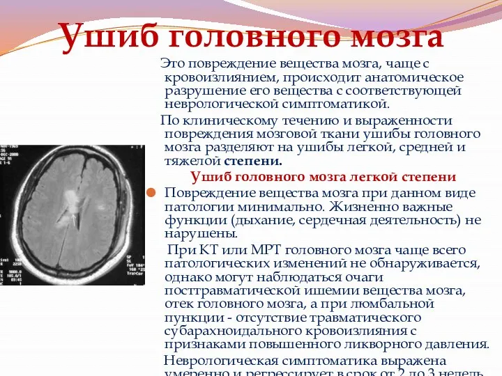 Ушиб головного мозга Это повреждение вещества мозга, чаще с кровоизлиянием,