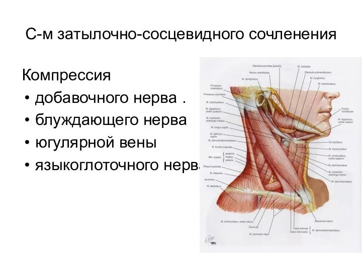 С-м затылочно-сосцевидного сочленения Компрессия добавочного нерва . блуждающего нерва югулярной вены языкоглоточного нерва