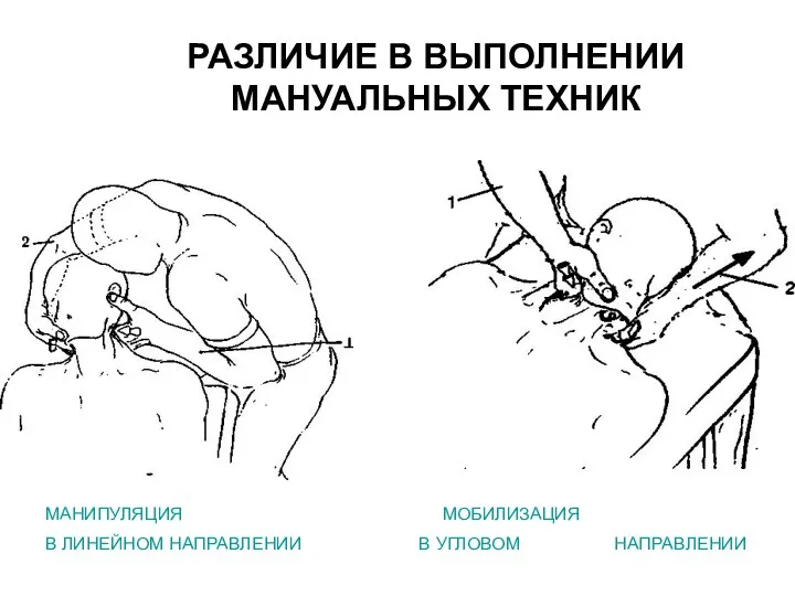 РАЗЛИЧИЕ В ВЫПОЛНЕНИИ МАНУАЛЬНЫХ ТЕХНИК МАНИПУЛЯЦИЯ МОБИЛИЗАЦИЯ В ЛИНЕЙНОМ НАПРАВЛЕНИИ В УГЛОВОМ НАПРАВЛЕНИИ