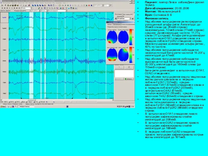 Пациент: повтор Ляхов собакаДжек ррссел терьер, Дата обследования: 20.05.2006 Монтаж: Монополярный 8 Врач: