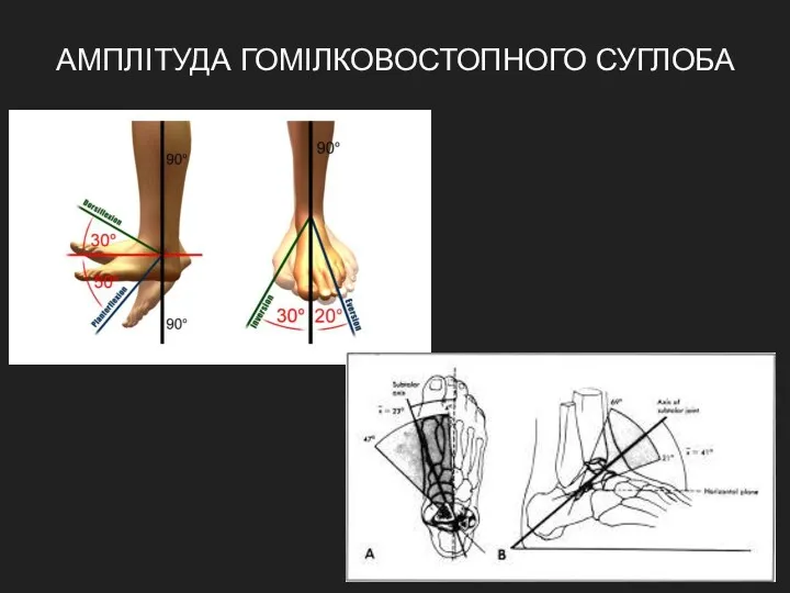 АМПЛІТУДА ГОМІЛКОВОСТОПНОГО СУГЛОБА