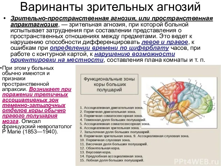 Варинанты зрительных агнозий Зрительно-пространственная агнозия, или пространственная апрактагнозия, — зрительная агнозия, при которой