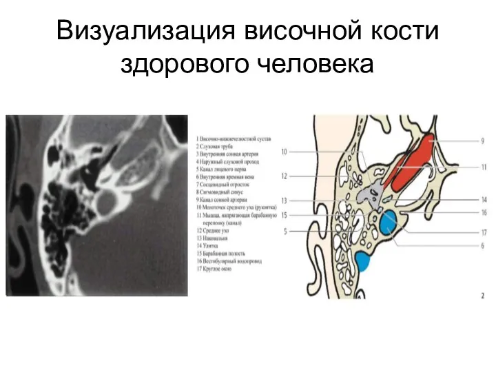 Визуализация височной кости здорового человека