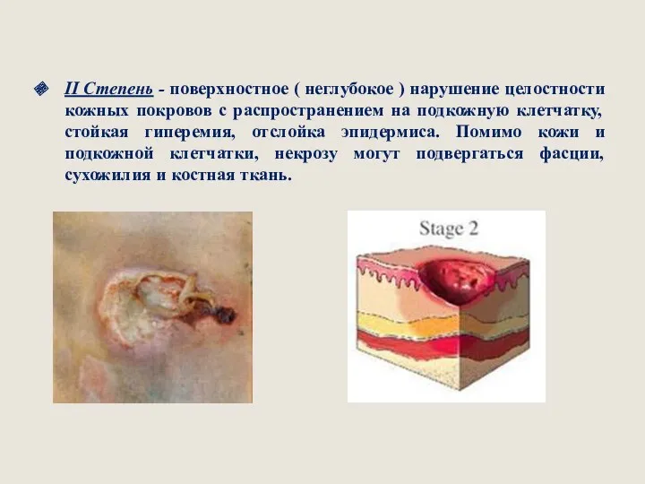 II Степень - поверхностное ( неглубокое ) нарушение целостности кожных