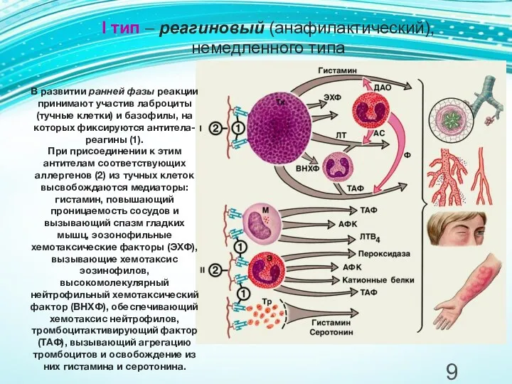 I тип – реагиновый (анафилактический), немедленного типа В развитии ранней