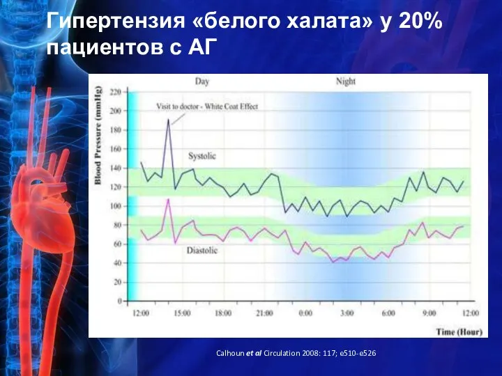 Гипертензия «белого халата» у 20% пациентов с АГ Calhoun et al Circulation 2008: 117; e510-e526