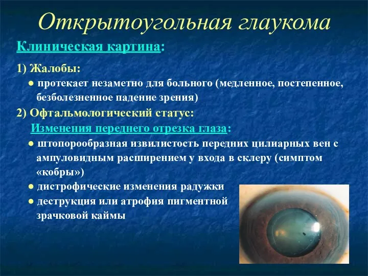 Открытоугольная глаукома Клиническая картина: 1) Жалобы: ● протекает незаметно для больного (медленное, постепенное,