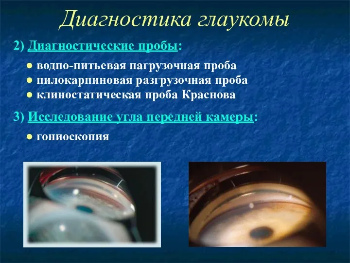 Диагностика глаукомы 2) Диагностические пробы: ● водно-питьевая нагрузочная проба ● пилокарпиновая разгрузочная проба