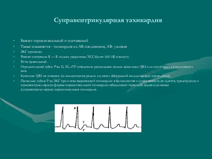 Суправентрикулярная тахикардия Бывает пароксизмальной и постоянной Также называется - тахикардия