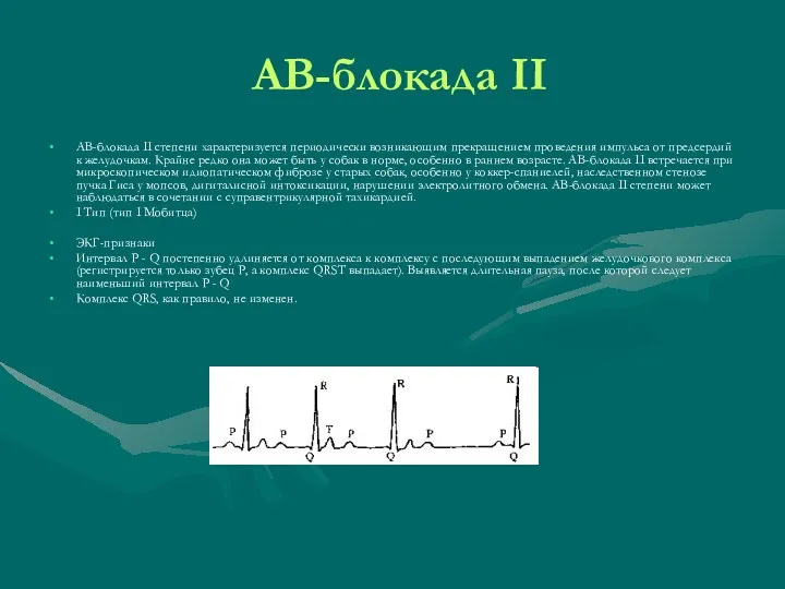 АВ-блокада II АВ-блокада II степени характеризуется периодически возникающим прекращением проведения