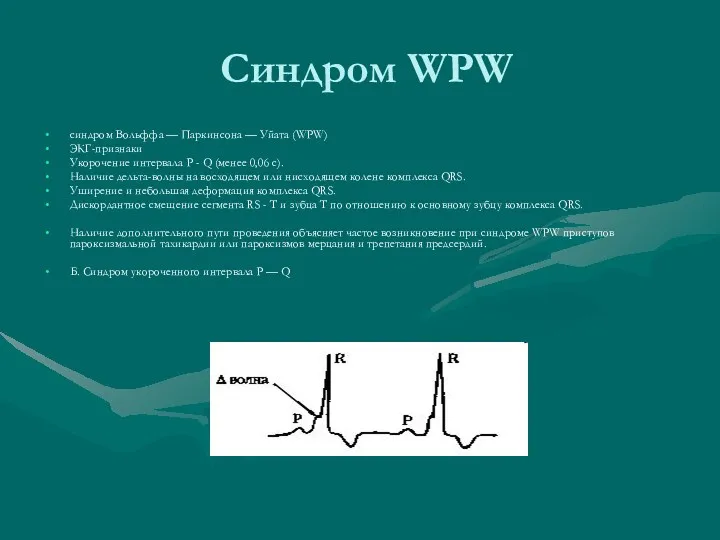 Синдром WPW синдром Вольффа — Паркинсона — Уйата (WPW) ЭКГ-признаки