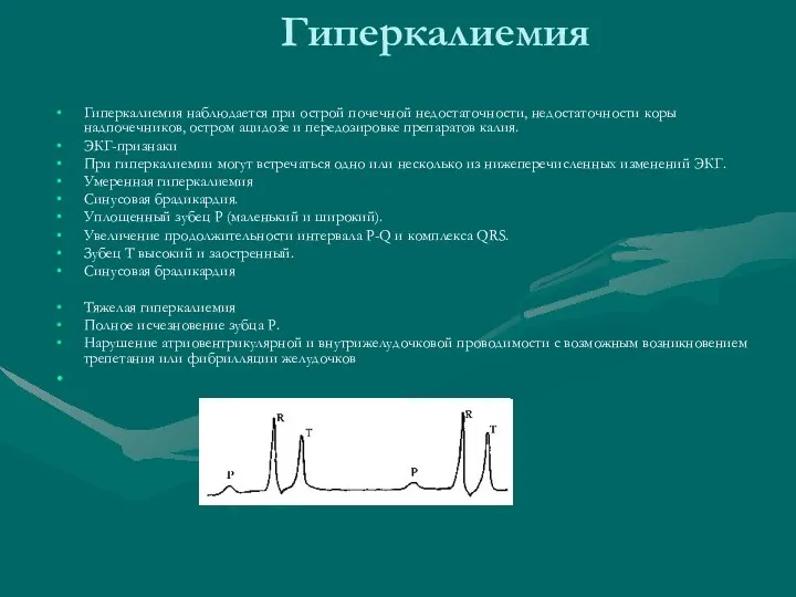 Гиперкалиемия Гиперкалиемия наблюдается при острой почечной недостаточности, недостаточности коры надпочечников,