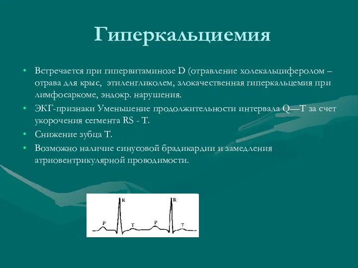 Гиперкальциемия Встречается при гипервитаминозе D (отравление холекальциферолом – отрава для