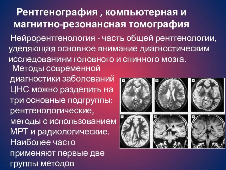 Нейрорентгенология - часть общей рентгенологии, уделяющая основное внимание диагностическим исследованиям головного и спинного