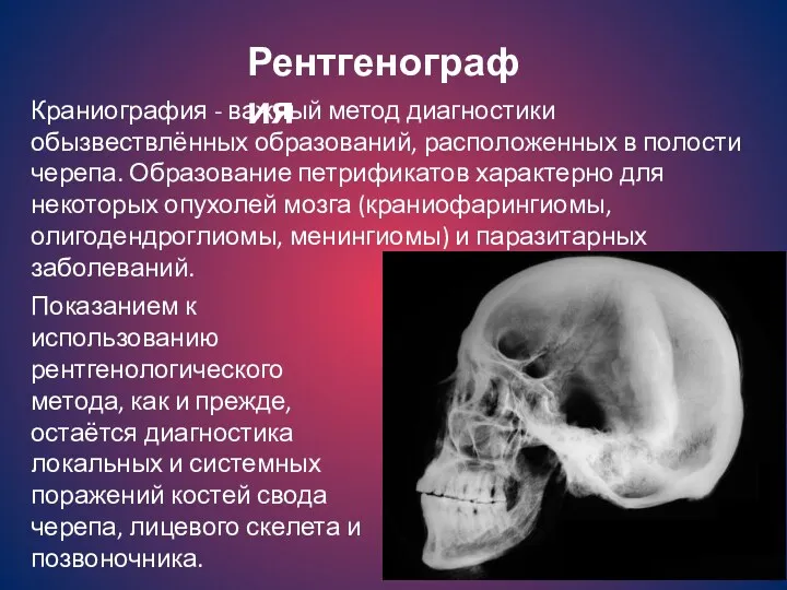 Показанием к использованию рентгенологического метода, как и прежде, остаётся диагностика