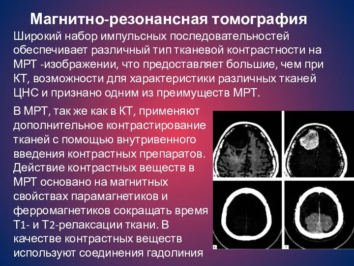 Магнитно-резонансная томография Широкий набор импульсных последовательностей обеспечивает различный тип тканевой контрастности на МРТ