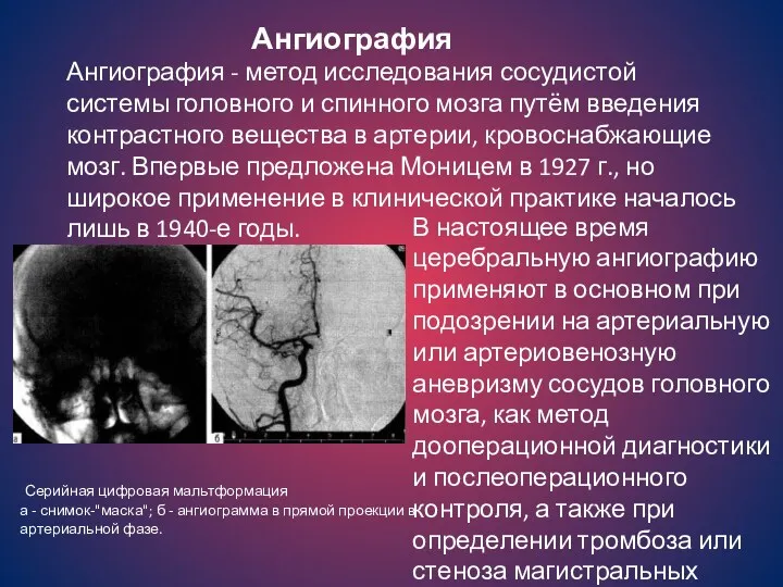 Ангиография Ангиография - метод исследования сосудистой системы головного и спинного