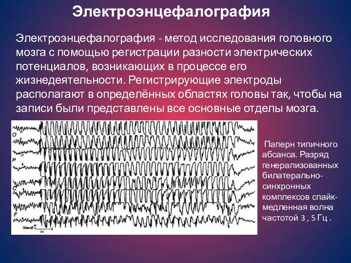 Электроэнцефалография Электроэнцефалография - метод исследования головного мозга с помощью регистрации разности электрических потенциалов,