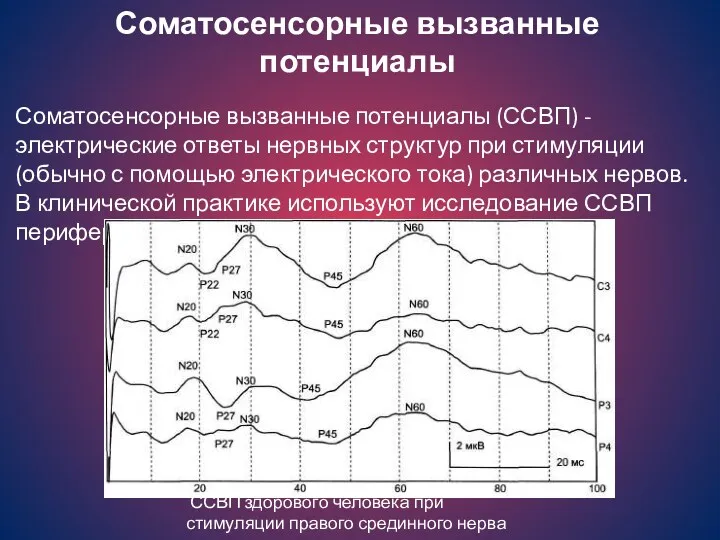 Соматосенсорные вызванные потенциалы Соматосенсорные вызванные потенциалы (ССВП) - электрические ответы