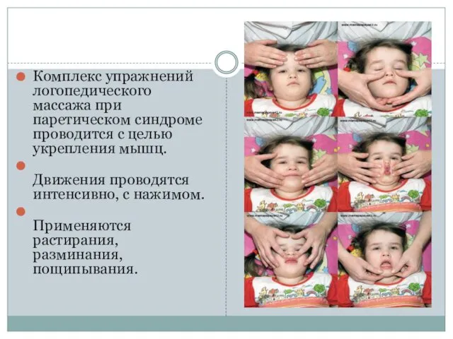 Комплекс упражнений логопедического массажа при паретическом синдроме проводится с целью