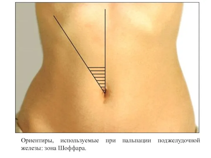 Ориентиры, используемые при пальпации поджелудочной железы: зона Шоффара.