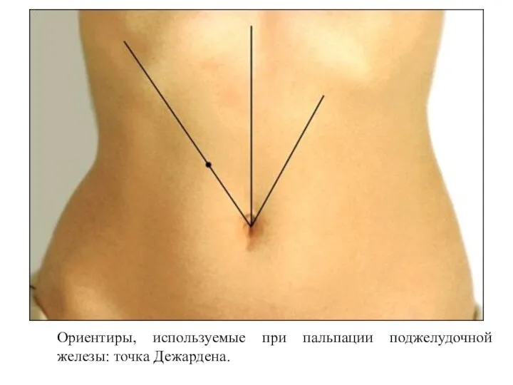 Ориентиры, используемые при пальпации поджелудочной железы: точка Дежардена.