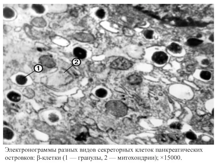 Электронограммы разных видов секреторных клеток панкреатических островков: β-клетки (1 — гранулы, 2 — митохондрии); ×15000.