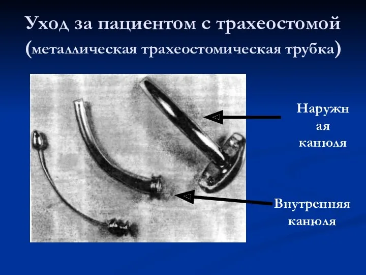 Уход за пациентом с трахеостомой (металлическая трахеостомическая трубка) Наружная канюля Внутренняя канюля