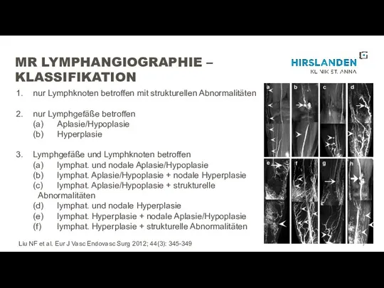 MR LYMPHANGIOGRAPHIE – KLASSIFIKATION nur Lymphknoten betroffen mit strukturellen Abnormalitäten