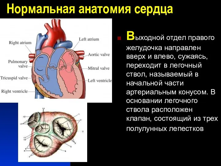 Нормальная анатомия сердца Выходной отдел правого желудочка направлен вверх и