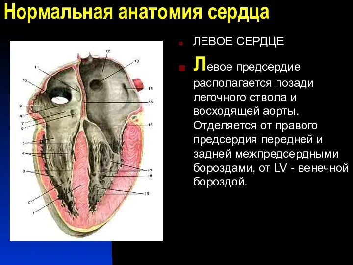 Нормальная анатомия сердца ЛЕВОЕ СЕРДЦЕ Левое предсердие располагается позади легочного