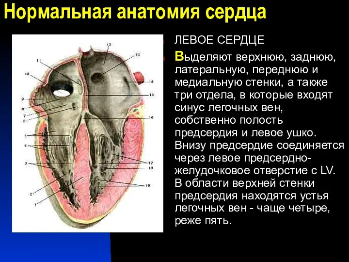 Нормальная анатомия сердца ЛЕВОЕ СЕРДЦЕ Выделяют верхнюю, заднюю, латеральную, переднюю