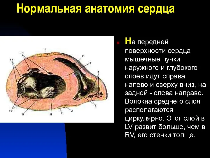 Нормальная анатомия сердца На передней поверхности сердца мышечные пучки наружного