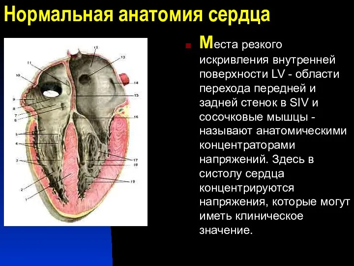 Нормальная анатомия сердца Места резкого искривления внутренней поверхности LV -